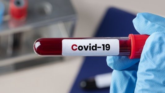 Cannes dresse un premier bilan chiffré des mesures prises pour faire face au Covid-19