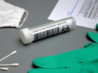 Les employeurs pourront proposer aux salariés volontaires des tests antigéniques
