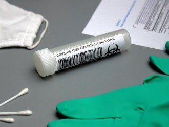 Covid : Un test généralisé pour les agents de la Ville de Nice et de la Métropole Nice Côte d'Azur ?